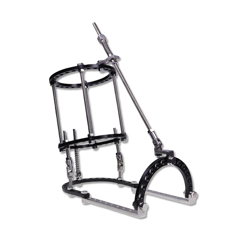 Equinus and Ankle Fusion Configuration of Ring External Fixator